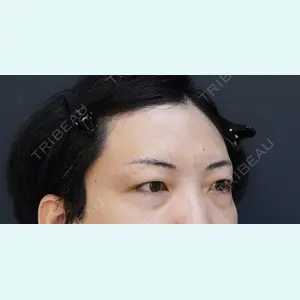 コスメディカルクリニック シンシア 銀座院 村松 正法医師の症例