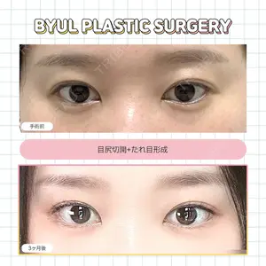ビョル美容外科の症例