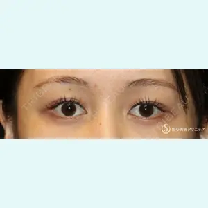 聖心美容クリニック 六本木院 綾部 奈々子医師の症例