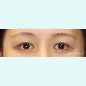 聖心美容クリニック 六本木院 綾部 奈々子医師の症例