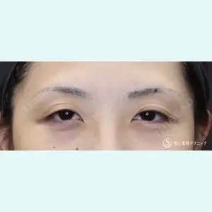 聖心美容クリニック 六本木院 綾部 奈々子医師の症例