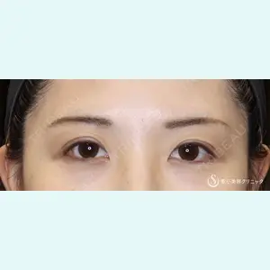 聖心美容クリニック 六本木院 綾部 奈々子医師の症例
