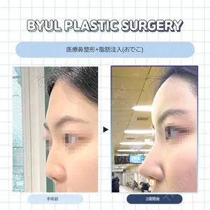 ビョル美容外科の症例