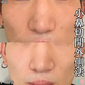 症例