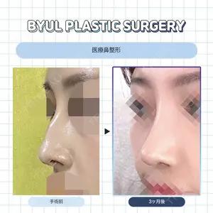 ビョル美容外科の症例