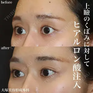 大塚美容形成外科 銀座本院 石井秀典医師の症例