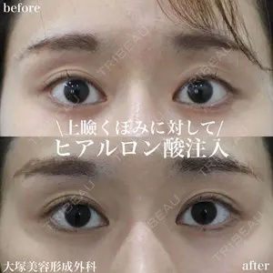 大塚美容形成外科 銀座本院 石井秀典医師の症例