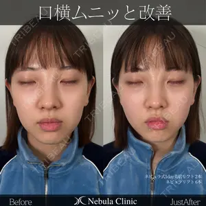 症例