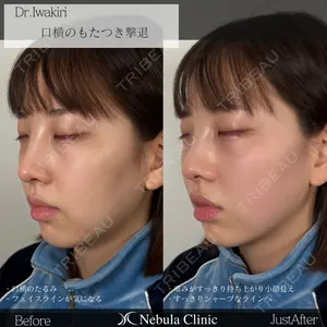 症例