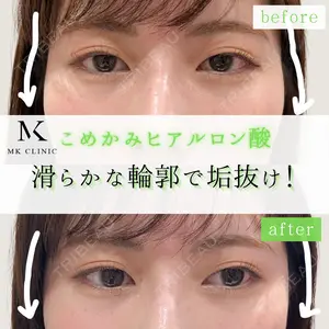 MKクリニック 日本橋院 石田雄太郎医師の症例