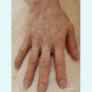 聖心美容クリニック 熱海院 小林 美幸（皮膚科）医師の症例