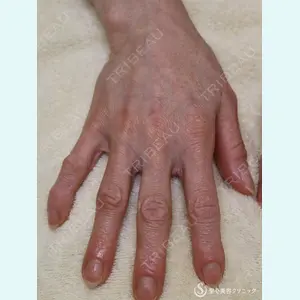 聖心美容クリニック 熱海院 小林 美幸（皮膚科）医師の症例
