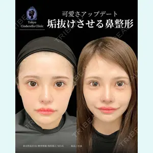 東京シンデレラ美容外科 新宿院 吉原 伯医師の症例