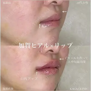 症例