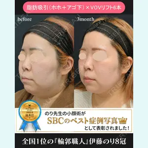 湘南美容クリニック 川崎院 伊藤 賀敏医師の症例