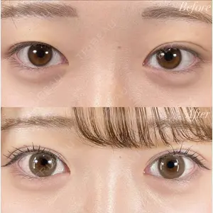 R Beauty CLINIC 銀座院 富田 莉沙子医師の症例