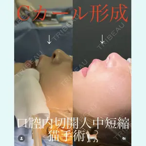 症例