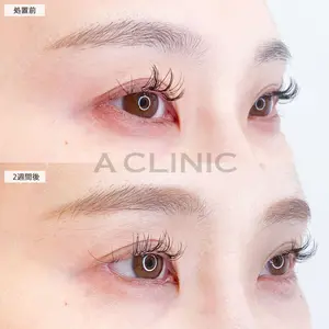 A CLINIC（エークリニック） 大阪院 田窪 賢志郎医師の症例