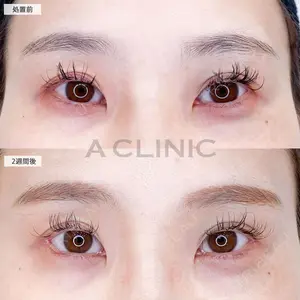 A CLINIC（エークリニック） 大阪院 田窪 賢志郎医師の症例