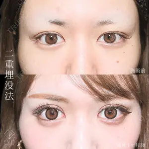 症例