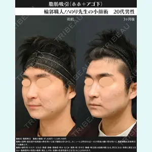 湘南美容クリニック 川崎院 伊藤 賀敏医師の症例