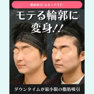 湘南美容クリニック 川崎院 伊藤 賀敏医師の症例