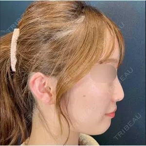 Days Beauty Clinicの症例