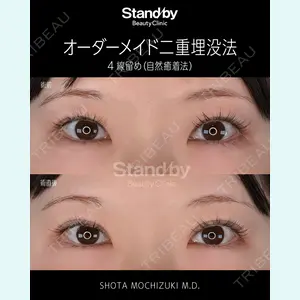 望月 聖太医師の症例