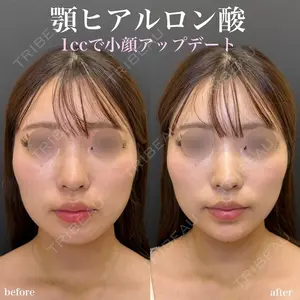 ルラ美容クリニック 名古屋栄院 関戸 優医師の症例