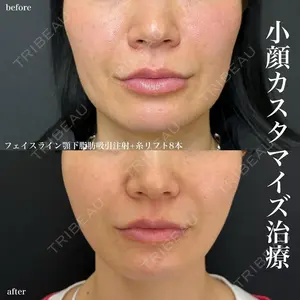 ルラ美容クリニック 名古屋栄院 関戸 優医師の症例