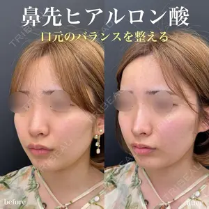 ルラ美容クリニック 名古屋栄院 関戸 優医師の症例