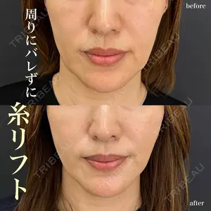 ルラ美容クリニック 名古屋栄院 関戸 優医師の症例