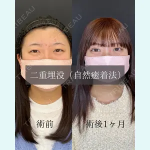ルラ美容クリニック 名古屋栄院 鶴田 佳雅医師の症例