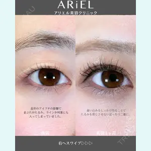 アリエル美容クリニック 郡山院 安齋 誠基医師の症例