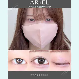 アリエル美容クリニック 郡山院 安齋 誠基医師の症例