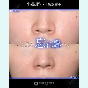 症例