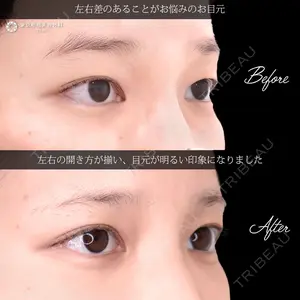東京形成美容外科 船橋院 弓削田　浩主医師の症例