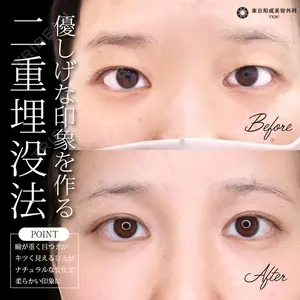 症例