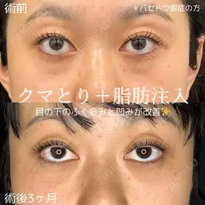 症例