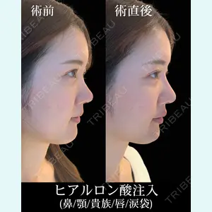 HAAB×DREAM BEAUTY CLINIC 東京本院 佐野 圭医師の症例