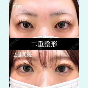 HAAB×DREAM BEAUTY CLINIC 東京本院 萩原 昂医師の症例