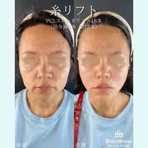 Brandnew Beauty Clinic 平山 容成医師の症例