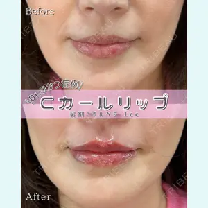 症例