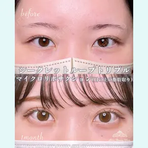 Shion Beauty Clinic 橋本 詩音医師の症例