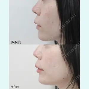 L‘amour clinic Tokyo【ラムールクリニック東京】の症例