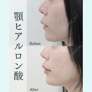 L‘amour clinic Tokyo【ラムールクリニック東京】の症例