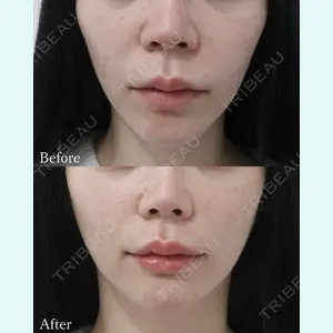 L‘amour clinic Tokyo【ラムールクリニック東京】の症例
