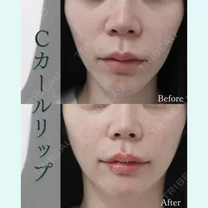 L‘amour clinic Tokyo【ラムールクリニック東京】の症例