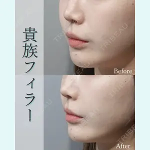 L‘amour clinic Tokyo【ラムールクリニック東京】の症例