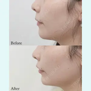 L‘amour clinic Tokyo【ラムールクリニック東京】の症例